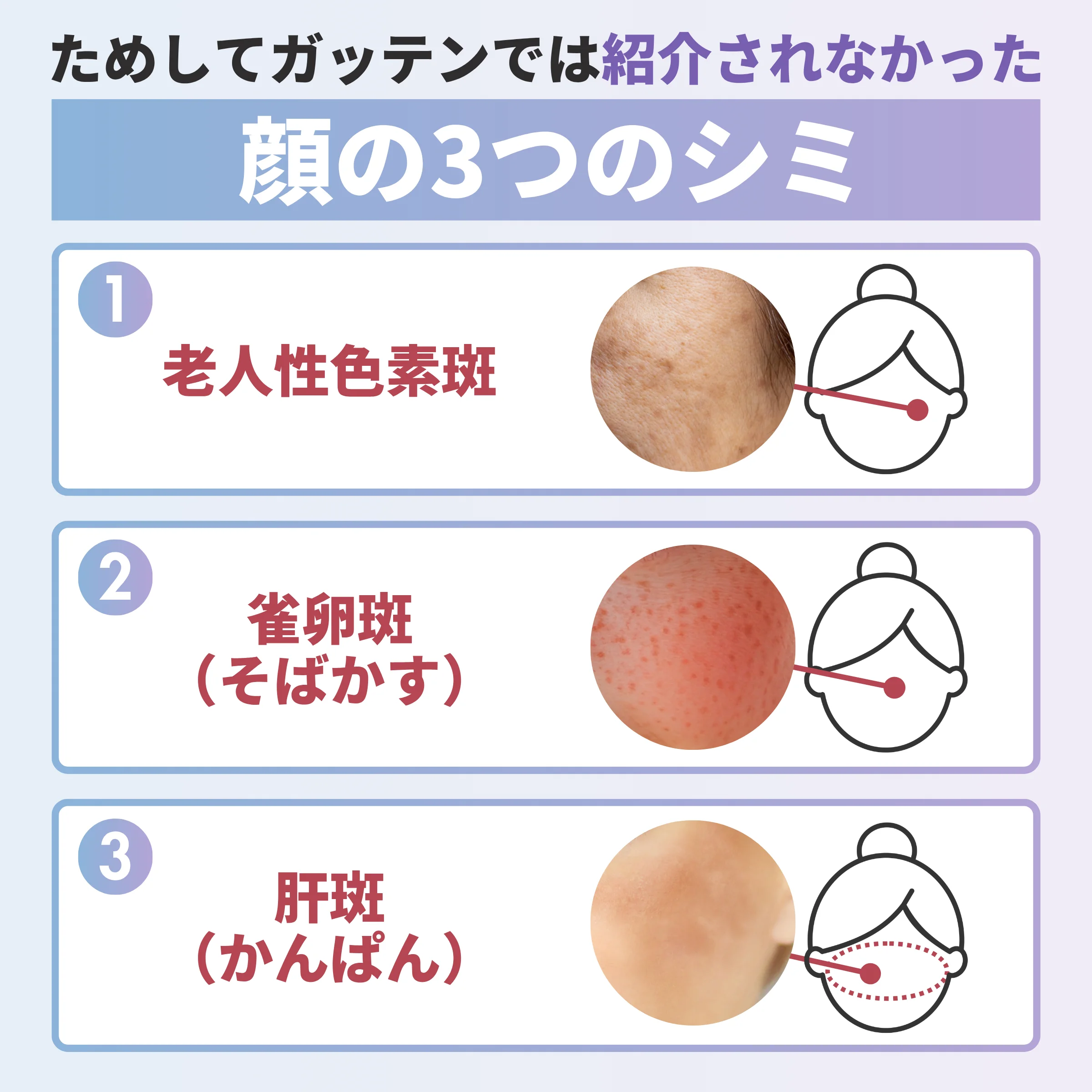 ためしてガッテンでは紹介されなかった顔の3つのシミ