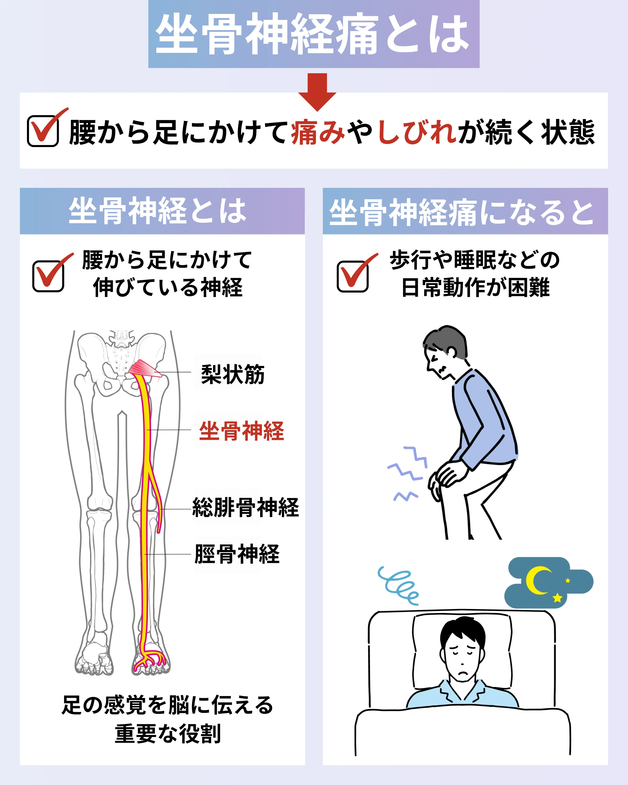 坐骨神経痛とは腰から足にかけて痛みやしびれが続く状態