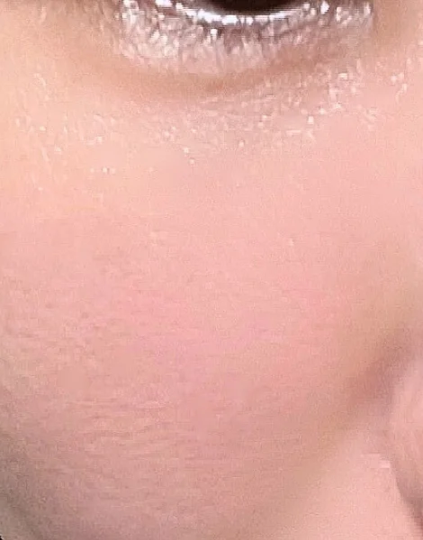 プラセントレックスジェル（PLACENTREX Gel）の使用ででトーンアップとメイクノリの改善を感じた頰